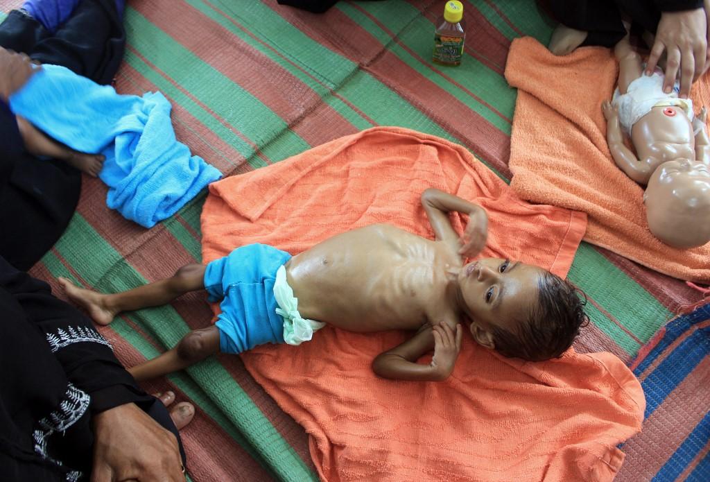 The number of Yemeni children in danger of death from lack of food has increased to 400,000, an increase of 22 percent over 2020, the World Food Programme said. (AFP)