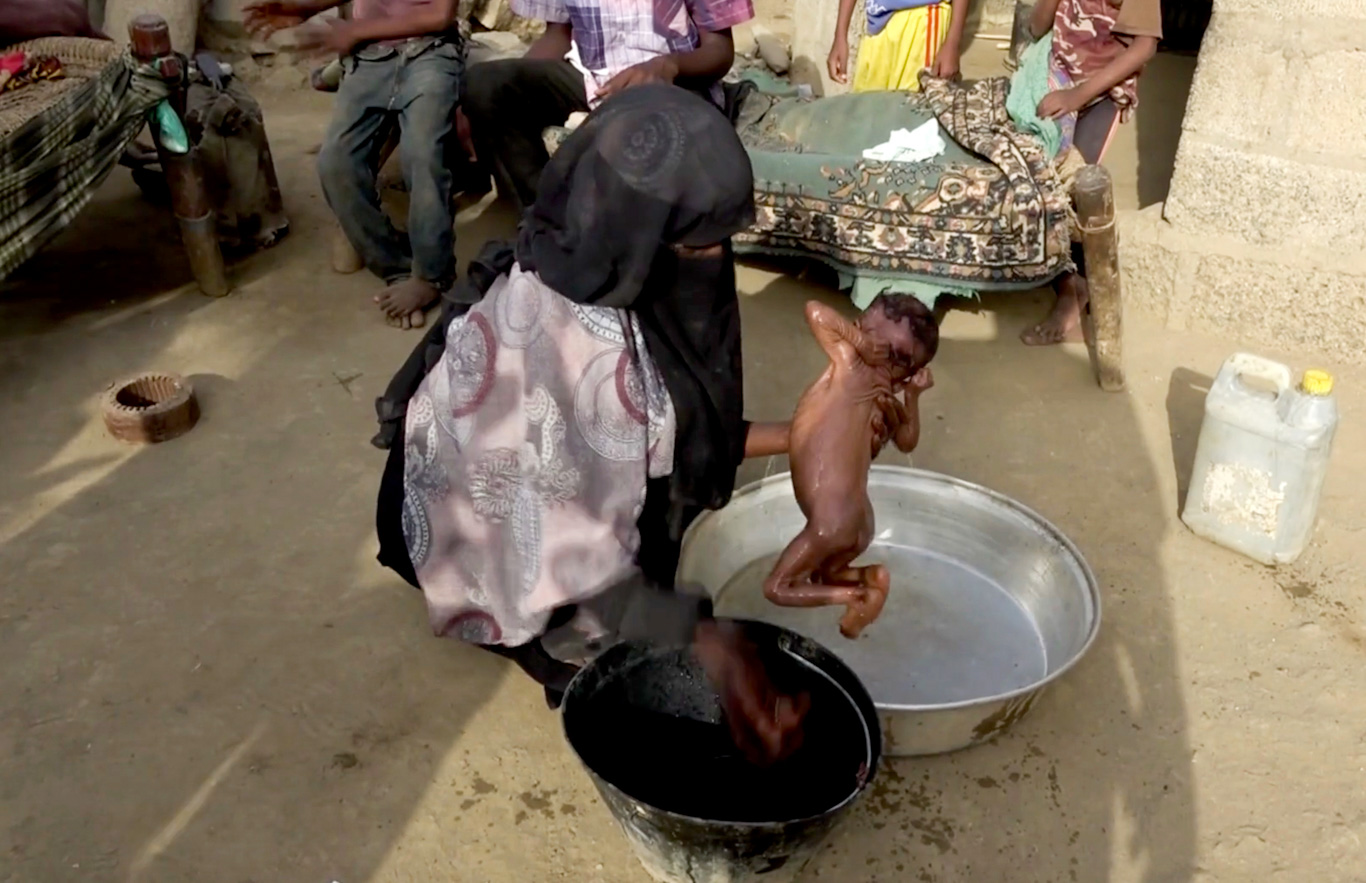 Yemen famine