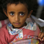 A malnourished child receives treatment at a hospital in Sanaa, Yemen, on November 1. (Mohammed Hamoud/Getty Images)